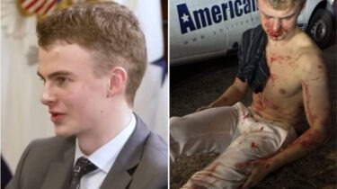 Split image of Edward Coristine speaking in a suit and sitting shirtless, bloodied after alleged assault.